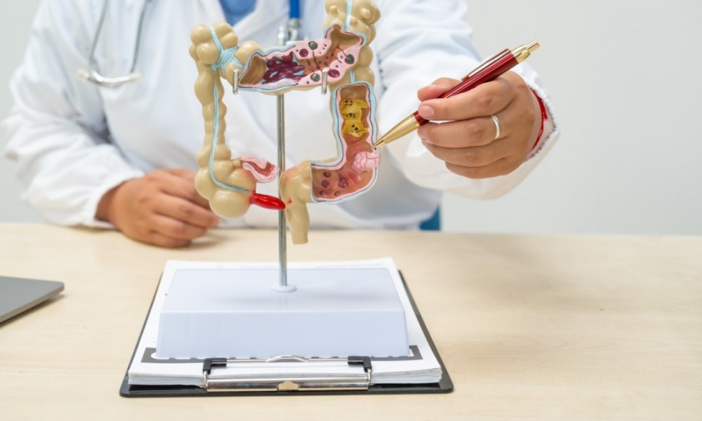 Kocaeli Proktoloji Kliniği