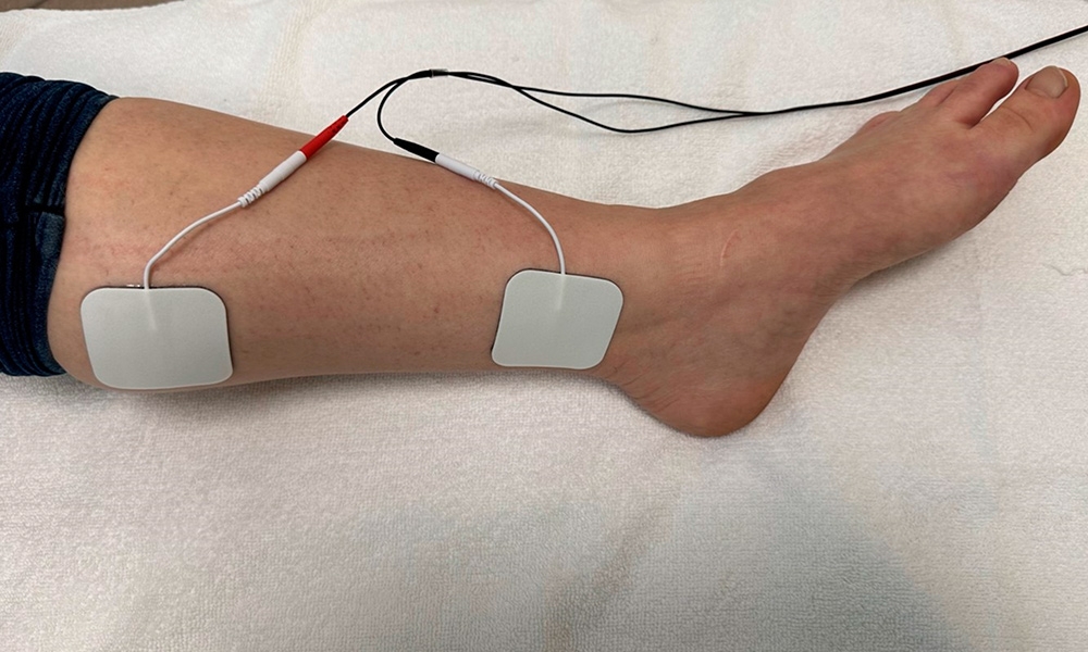 Perkütan Tibial Sinir Uygulaması